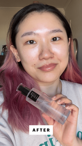 Han after applying the CosRx BHA Blackhead Power Liquid Treatment